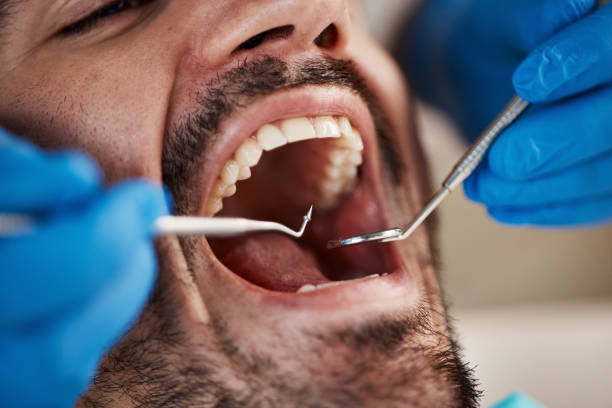 Best Urgent Dental Care for Toothache in Morristown, IN